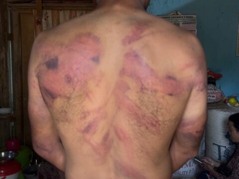 Nepali man allegedly Abducted and Assaulted over Kuki Identity in Manipur’s Imphal West